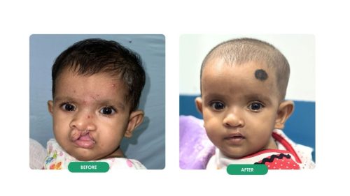shape-of-smile-kolkata-4