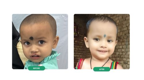 shape-of-smile-kolkata-5